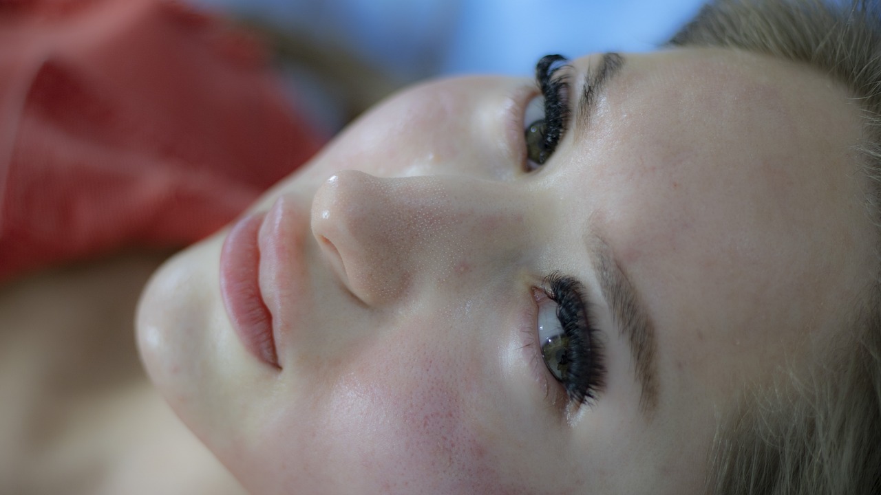 woman, skincare, facial treatment, dermatology, acne scars, skincare, skincare, facial treatment, dermatology, dermatology, dermatology, dermatology, dermatology, acne scars